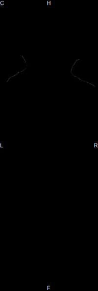 3D Fluorescence GIF by TriFoil Imaging