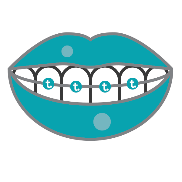 Braces Smile Sticker by Thurman Orthodontics