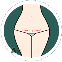 Brec Sticker by Nancy Anderson Fit