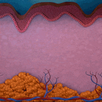 imdadgroup beauty aesthetic laser imdad GIF