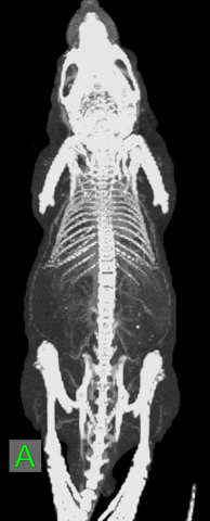 Ct Xray GIF by TriFoil Imaging