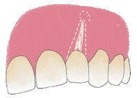 Endo Endodoncia Sticker