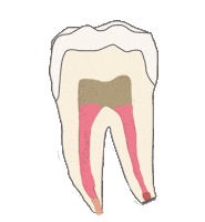 Endodoncia Sticker