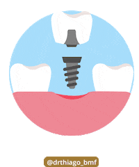 Surgery Odontologia Sticker by Dr Thiago Santana