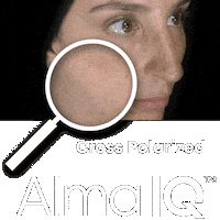 Skin Analyse Sticker by Alma Lasers GmbH
