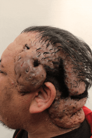 Change Transformation GIF by Dr. U Hair and Skin Clinic