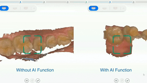 scannice giphyupload scanner intraoral shining3d GIF