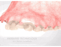 CHROMEGuidedSMILE smile amazing teeth dental GIF