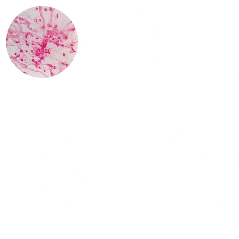 asudeasar giphyupload GIF