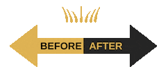 Istanbul Ankara Sticker by For Legend Hair
