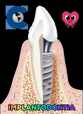 conexaosistemasdeprotese giphygifmaker giphyattribution tooth dente GIF