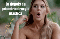 mkthubaide plastica hubaide marcushubaide doutormarcush GIF