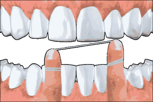Teeth Dentist GIF