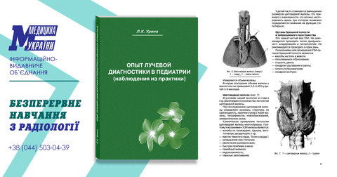 urctmrt giphyupload GIF