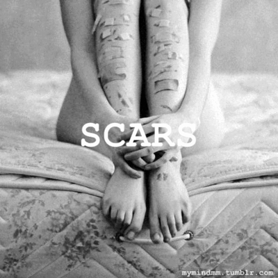 scars GIF