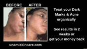 Unamiskincare GIF by draxymedia