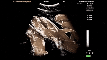 shark sonogram GIF