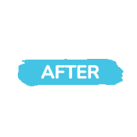 Teeth Whitening Sticker by Teeth Too Fresh