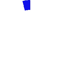 Type 1 Diabetes Sticker by Medtronic Diabetes