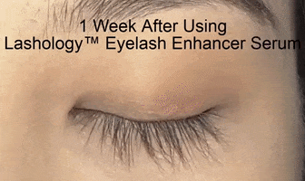 Eyelashserum Eyelashgrowth GIF by Lashology
