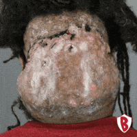 Before And After Transformation GIF by Dr. U Hair and Skin Clinic