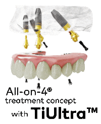 Teeth Smile Sticker by Nobel Biocare North America