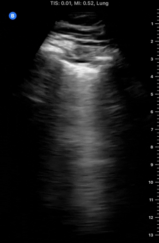 PocusMed giphyupload GIF