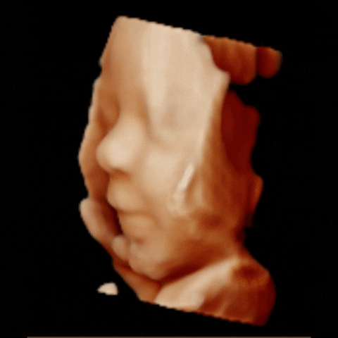 3dechobarendrecht giphyupload baby zwanger pretecho GIF