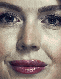 Vanity Fair Lip Filler GIF by Respective