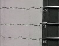 scrolling black and white GIF