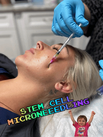 Stem Cell GIF by MidState Skin Institute