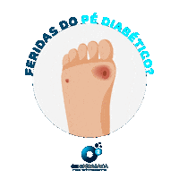 o2hiperbarica diabetes o2hiperbarica o2 hiperbarica oxigenoterapia Sticker