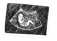 Ultrasound Sticker