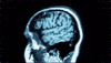brain anatomy GIF by Harvard University