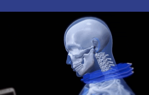 neckfix giphygifmaker neck pain neck traction pinched nerves GIF