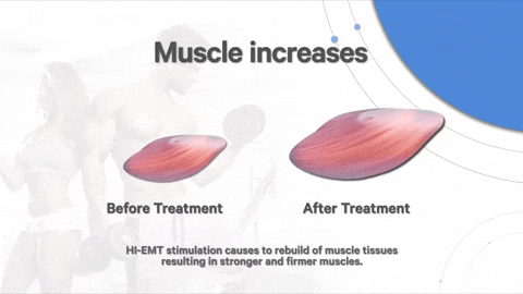 waiclinic giphyupload cmslim waiclinic GIF
