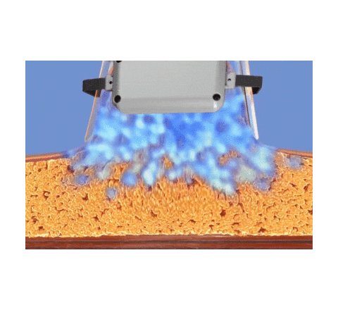 Ultraformer Enerjet Sticker by Expert Laser