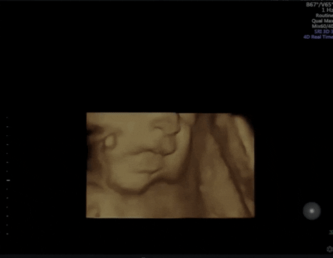 MissBeany giphyupload GIF
