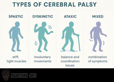 Cerebral Palsy Cp GIF