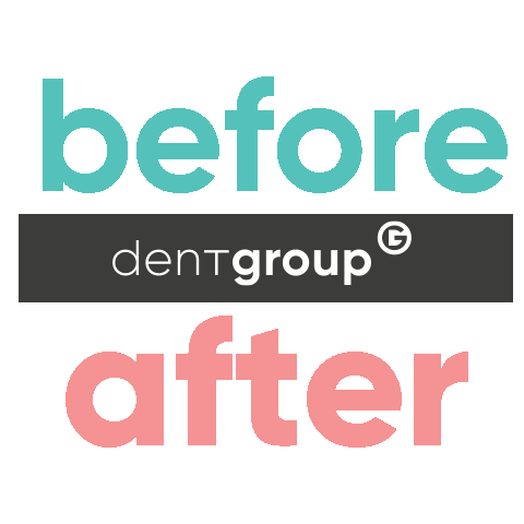 After Sticker by dentgroup