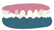 Odontoprotesis Sticker