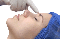 ReduxClinica redux rinomodelacion reduxclinica redux clinica Sticker