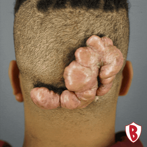 Before And After Transformation GIF by Dr. U Hair and Skin Clinic