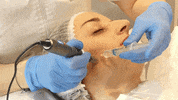 Marinel_Professionnel microneedling marinelprofessionnel GIF