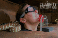 Im A Celebrity Au GIF by I'm A Celebrity... Get Me Out Of Here! Australia