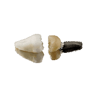 Anthogyr_de implant axiom implantat anthogyr Sticker