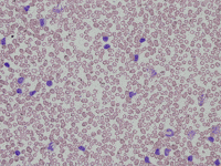 red blood cells GIF by Ansel Oommen