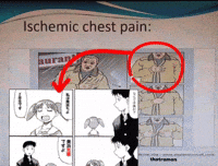 Heart Disease Pain GIF