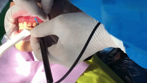 Dentistry Smile GIF by Apostol Dental