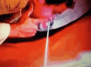 Chevy Chase Drugs GIF by absurdnoise